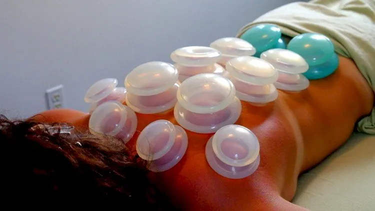 Cupping Massage Mastery